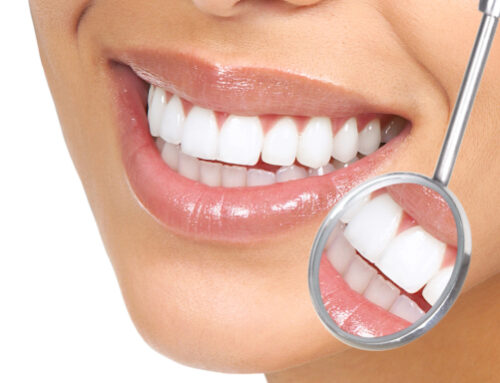 Guide to Teeth Whitening and How to Achieve a Brighter Smile